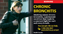 Woman suffering from chronic bronchitis.