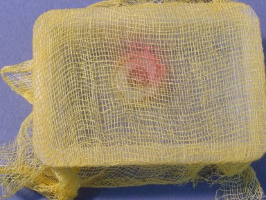 A close-up, top view of an object stored in a box covered in muslin with red discolouration visible on the muslin.