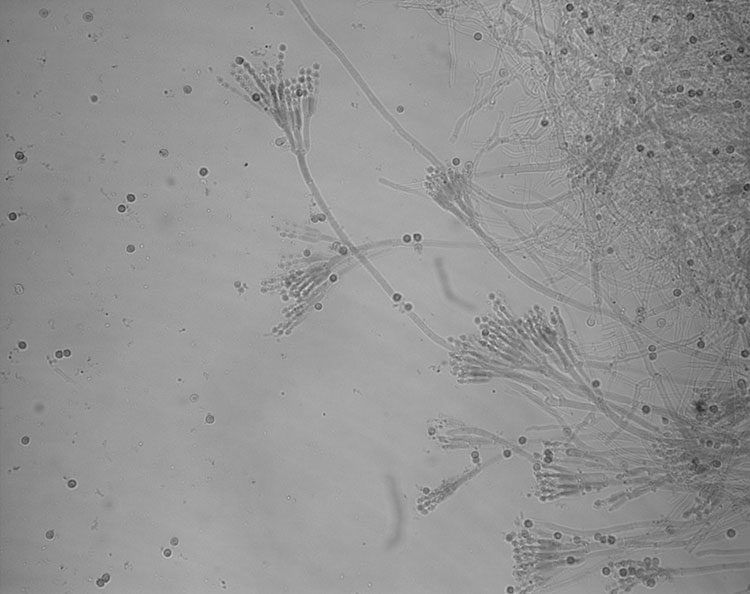 Conidia and conidiophores of a Penicillium species