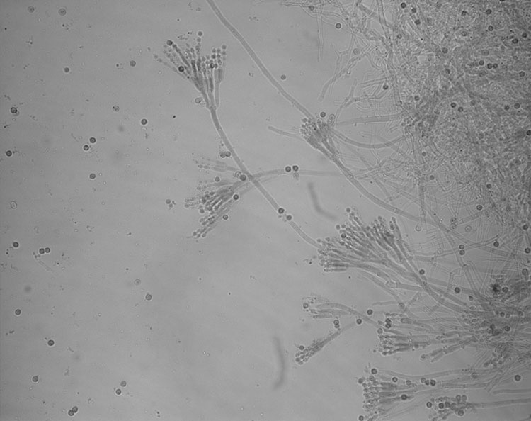 Conidies et conidiophores d’une espèce de Penicillium