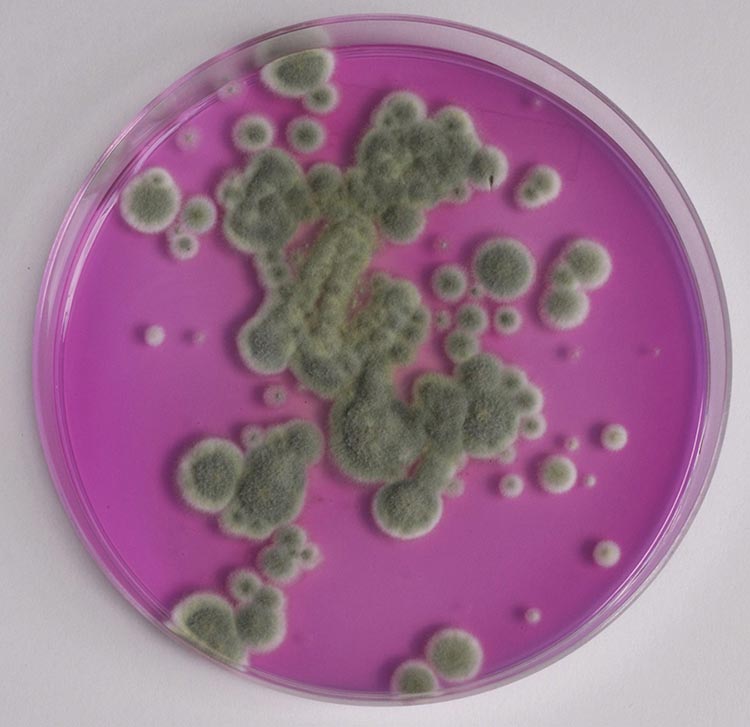 Agar plate of mould