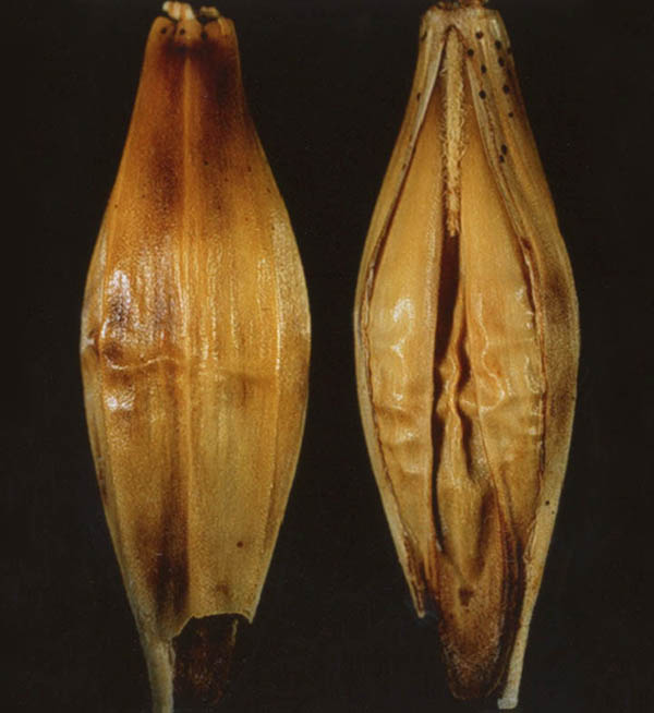 Barley Fungal pycnidia