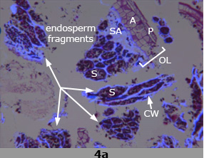 4a. Scanning electron micrograph images of fibre-rich fraction with components labeled.