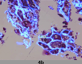 4b.Scanning electron micrograph images of enriched fibre-rich fraction with components labeled - enlarged.
