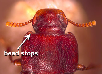 Lateral bead stops at anterior angle