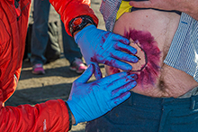 May 11, 2016. Warrant Officer Marc Charron from 424 Transport and Rescue Squadron attaches moulage on the abdomen of a simulated patient in preparation for the major air disaster (MAJAID) exercise during TIGEREX 16 in Sault Ste. Marie, Ontario on May 11, 2016. (Photo: Master Corporal Jonathan Barrette, Canadian Forces Combat Camera)