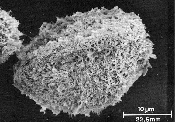 Figure 6. Micrographie électronique à balayage d’une microspore d’Isoetes prototypus (Britton et Goltz, 1991).