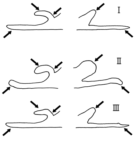 Figure 3. Diagramme illustrant les valves droite (à droite) et gauche des genitalia mâles.