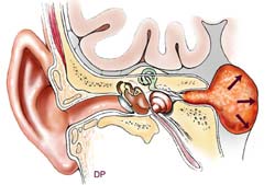 Anatomie de l'oreille humaine - description suit l'image