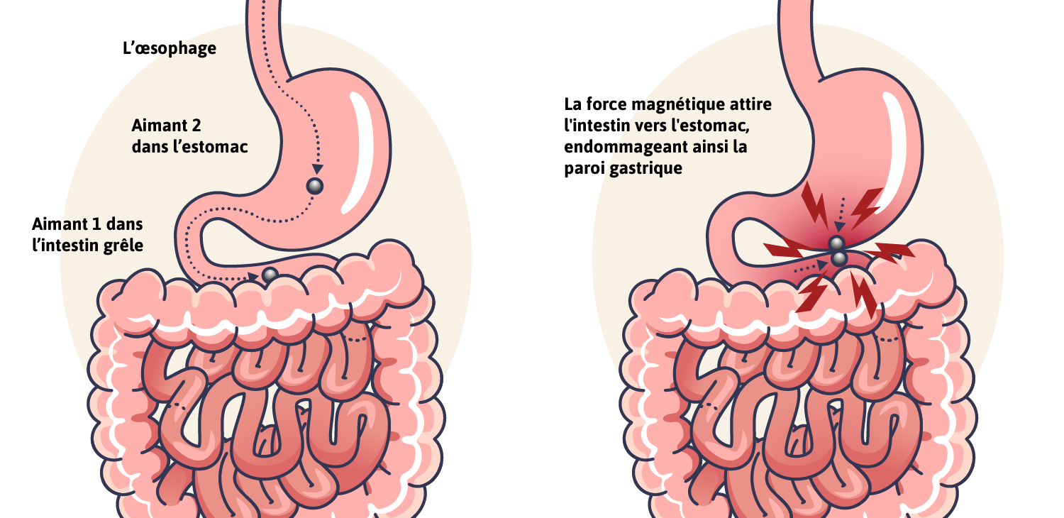 Risques pour la santé
