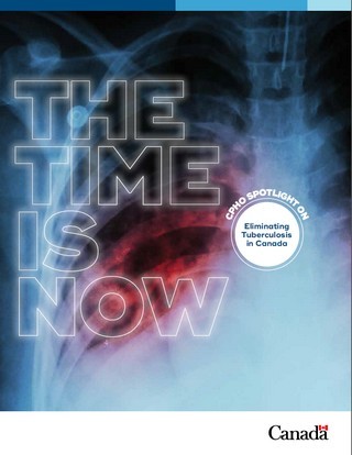 Cover Art for The Time is Now: Eliminating Tuberculosis in Canada