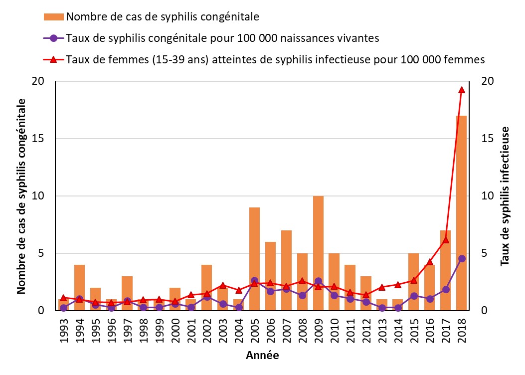 Figure 33. La version textuelle suit.