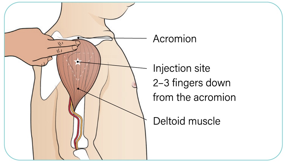 Figure 2. Text version below.