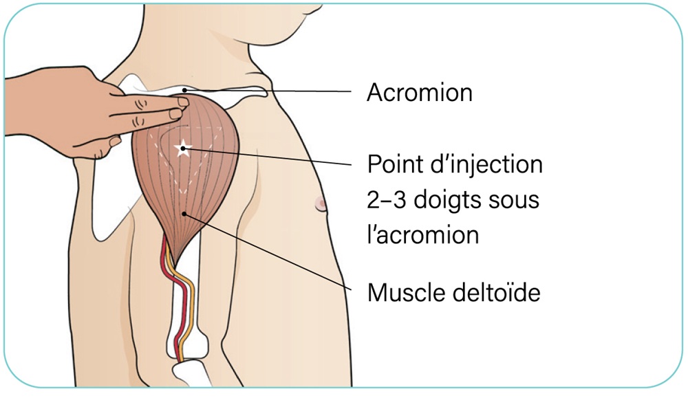 Figure 2. La version textuelle suit.
