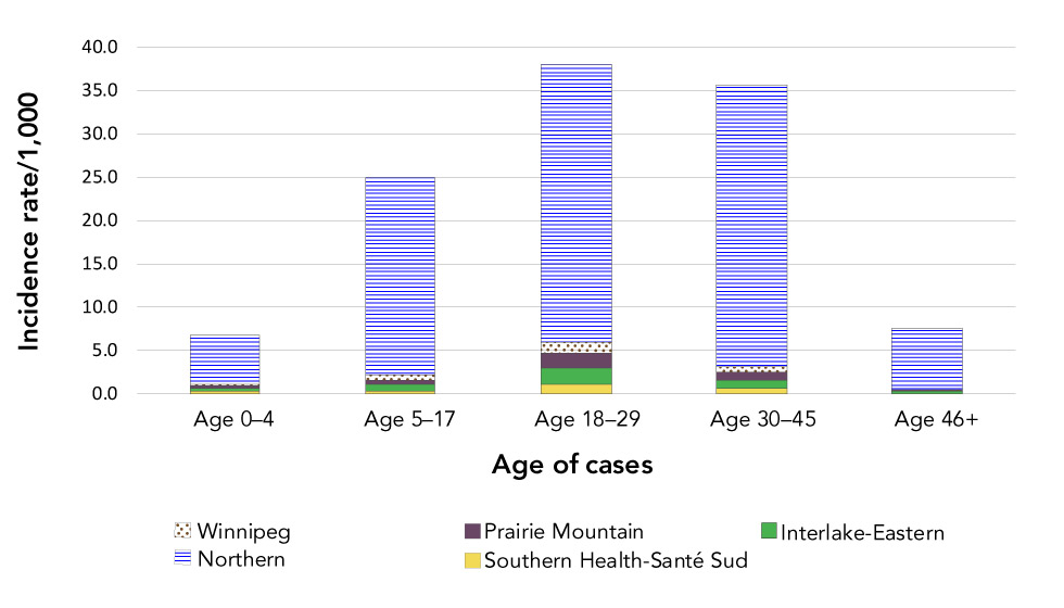 Figure 2: Cumulative incidence rate per 1,000 of mumps cases by age group and health region, Manitoba, Canada, September 2016–December 2018