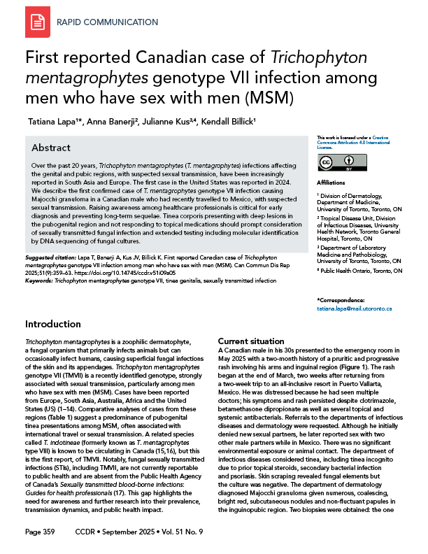 CCDR: Volume 51-9 (5), September 2025: cover image