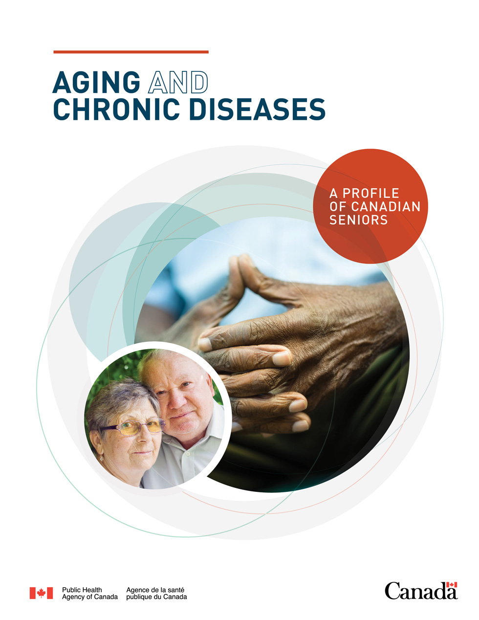 Aging and Chronic Diseases: A Profile of Canadian Seniors cover