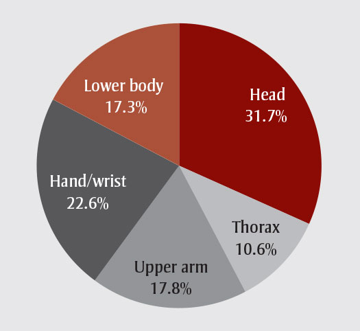 Anatomical location of acute curling injury, divided by grouping