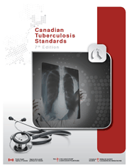 Canadian Tuberculosis Standards 7th Edition Chapter 15 - Prevention and Control of Tuberculosis Transmission in Health Care and Other Settings